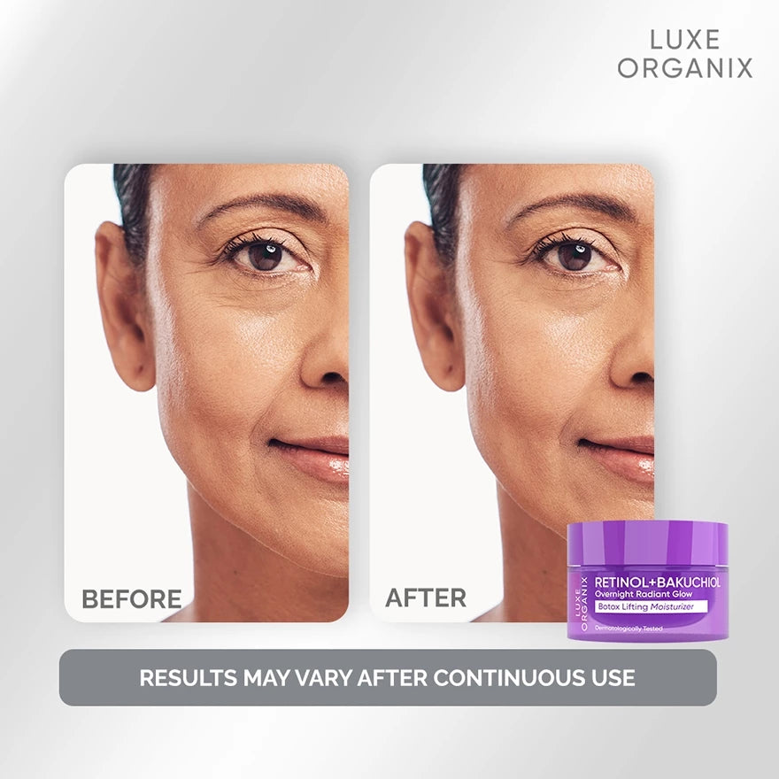 LUXE ORGANIX Retinol + Bakuchiol Overnight Radiant Glow Botox Lifting Moisturizer 50g
