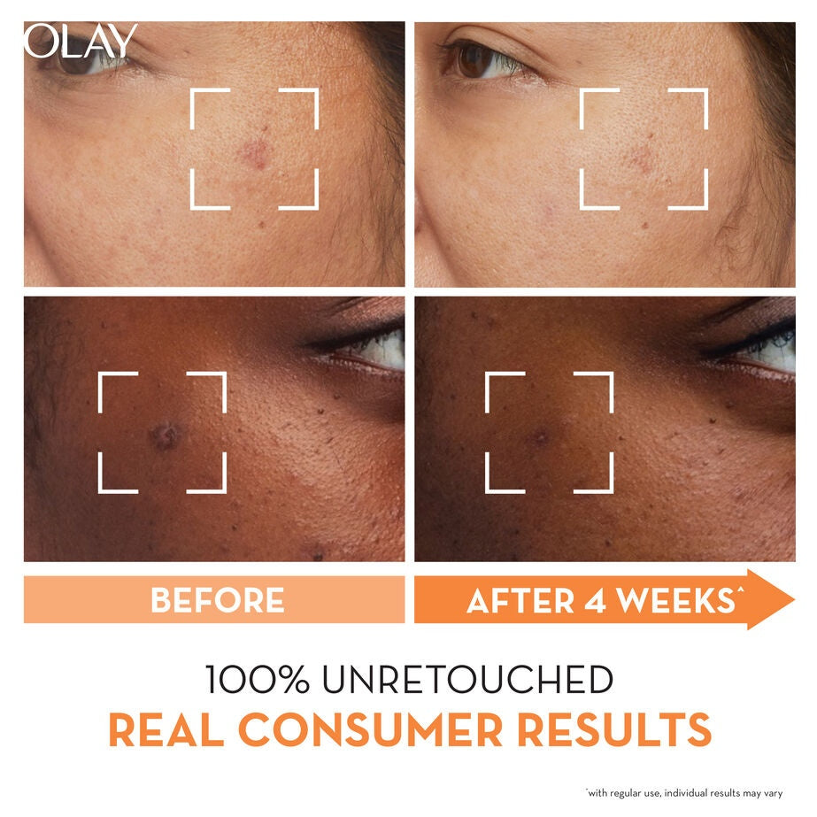 Olay Luminous Niacinamide + Vitamin C Super Serum: Dark Spot Corrector for Radiant Skin