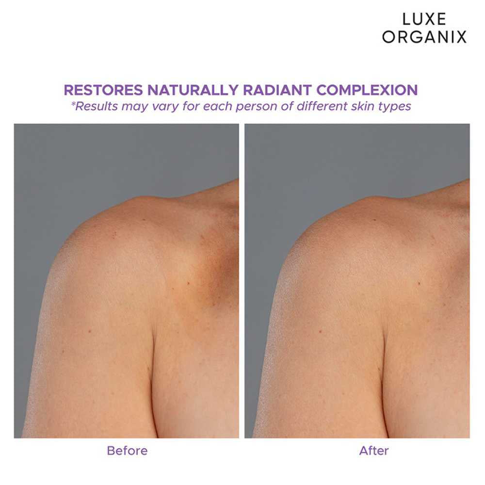 LUXE ORGANIX Retinol + Gluta Whitening Serum Lotion 350ml [ Buy 2, Get 50% Off ]